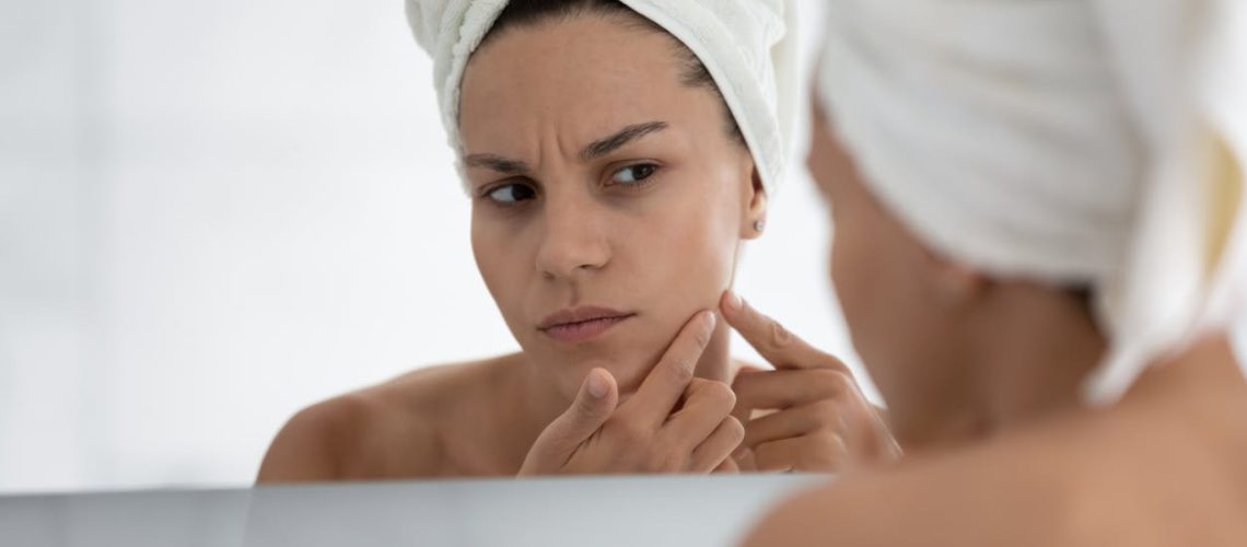 Acné liée au stress : comment limiter les dommages Acné liée au stress : comment limiter les dommages