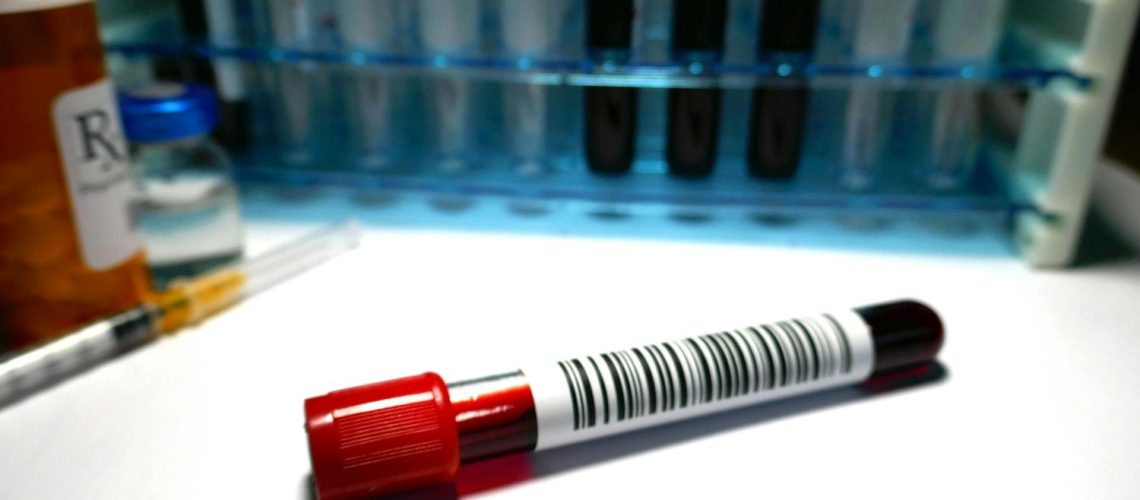 Maladie de Waldenström : symptômes, causes, traitements Maladie de Waldenström : symptômes, causes, traitements